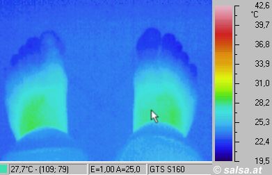 feet - (infrared pictures / thermography of a foot